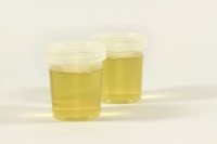 Mid-Stream Urine Sample - plain English summary of the original clinical research article